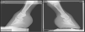 radiograph